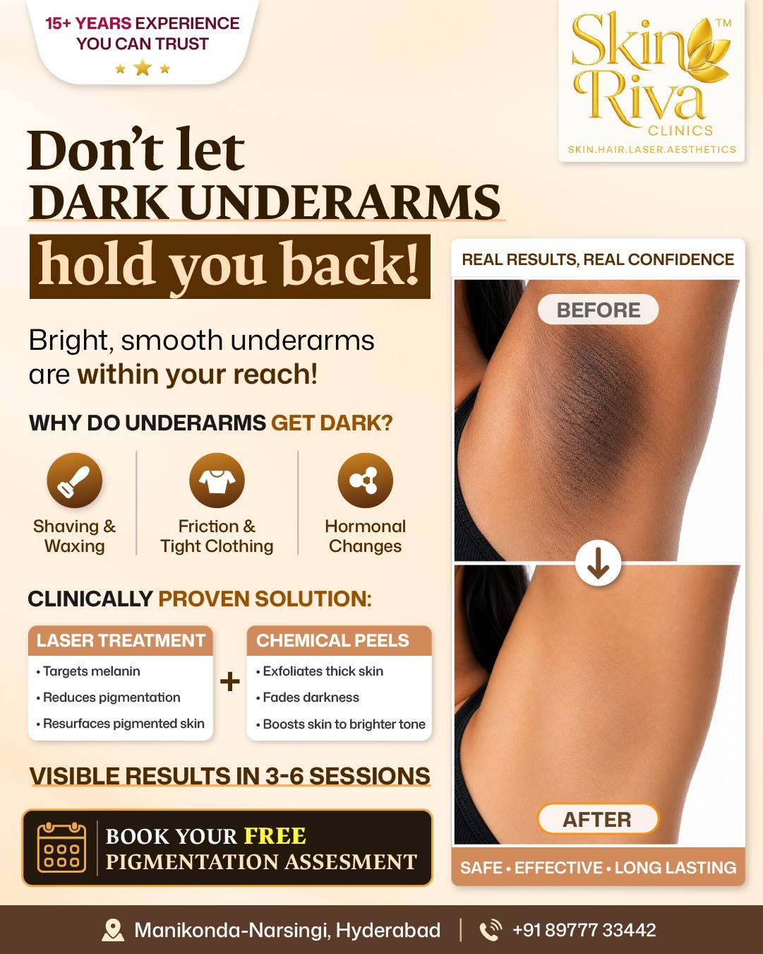 Skin Riva Instagram post on acne care